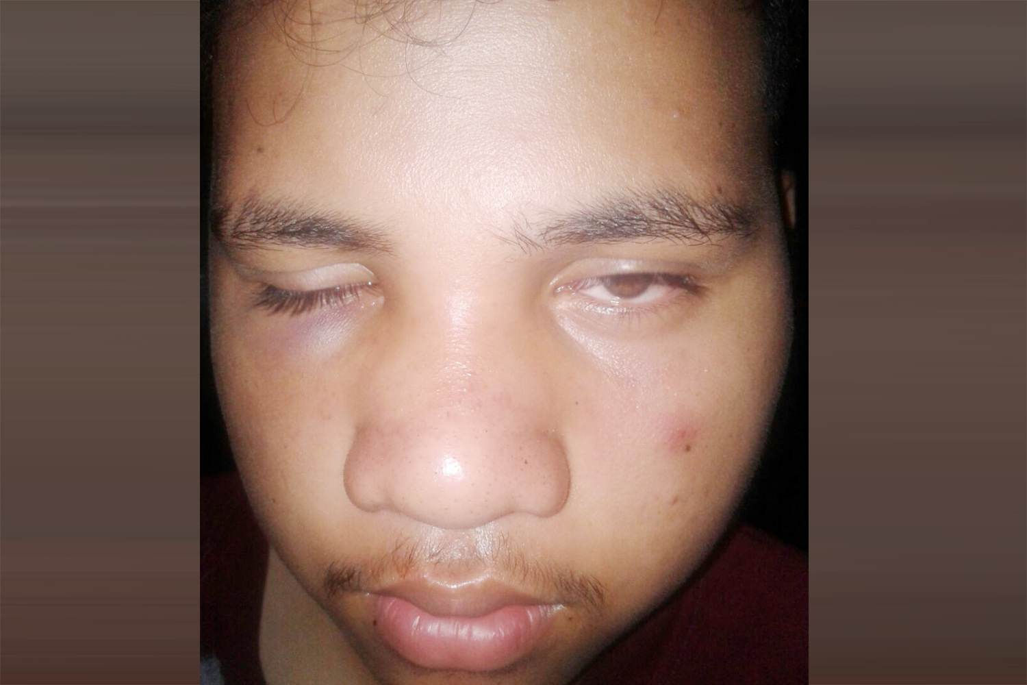 Brutal beating leaves  family shaken, angry