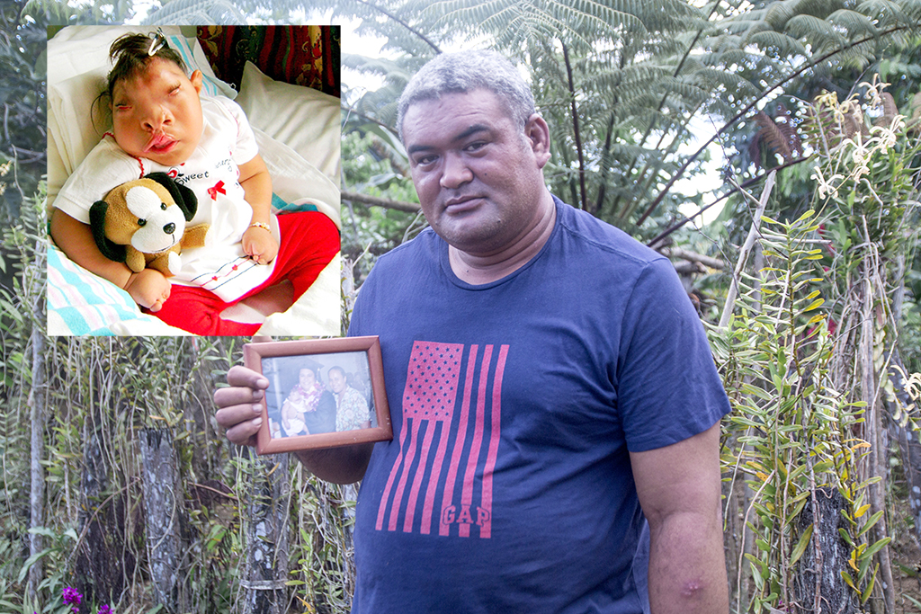 The end of a Miracle