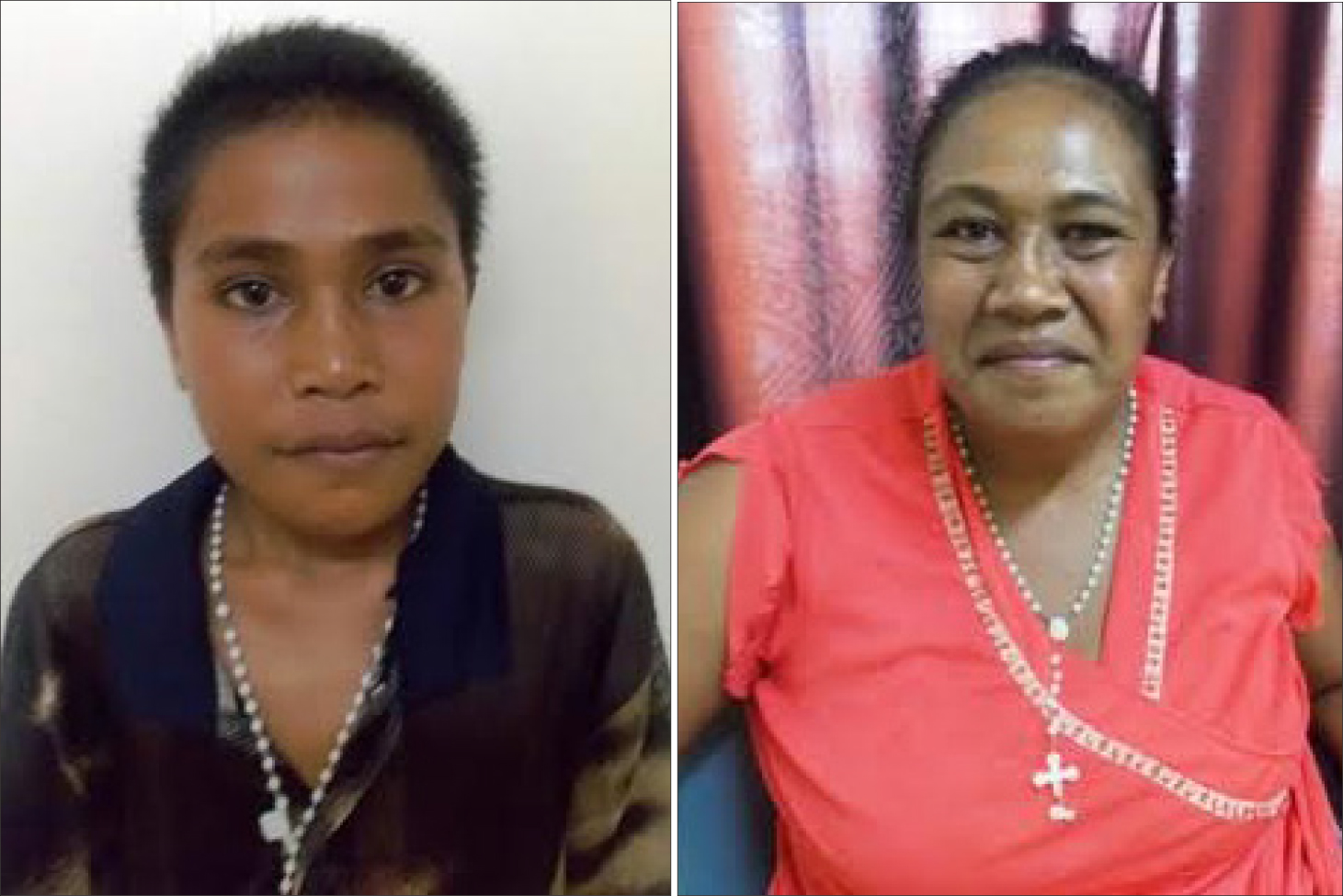Mother seeks help for her son
