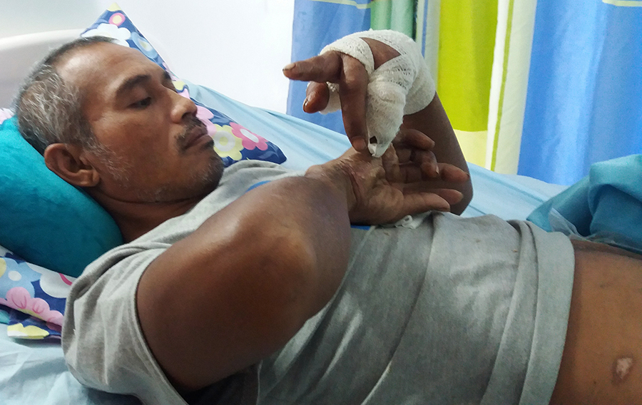 Shark attack victim: “I thought I was going to die"